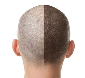 SMP Treatments